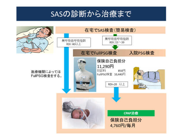 SASの診断から治療まで